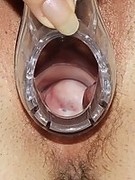 Nurse vulva fingering and dildoing at gyno clinic
