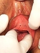 Mature having pussy gyno examined by doctor
